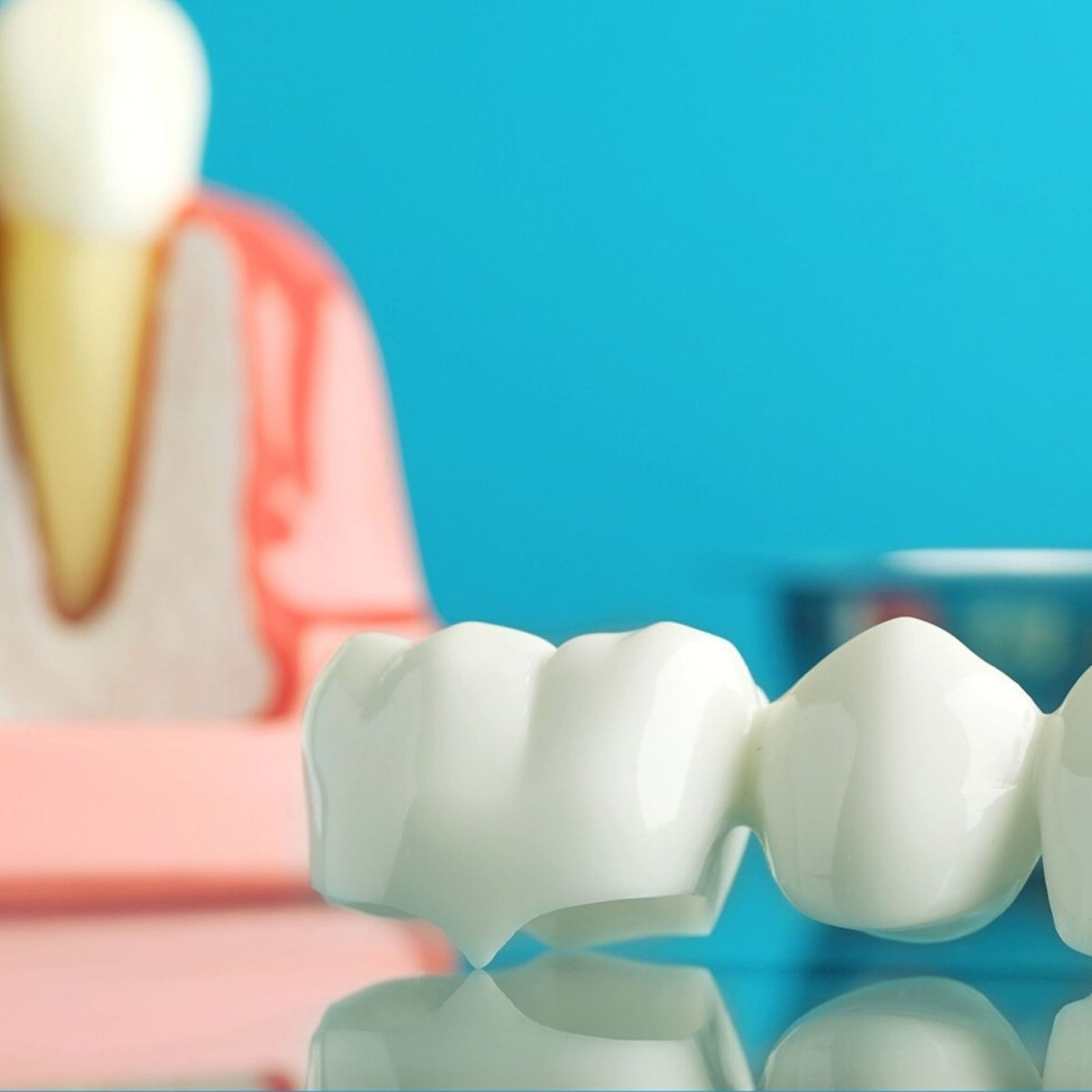 Zirconia crowns and bridges