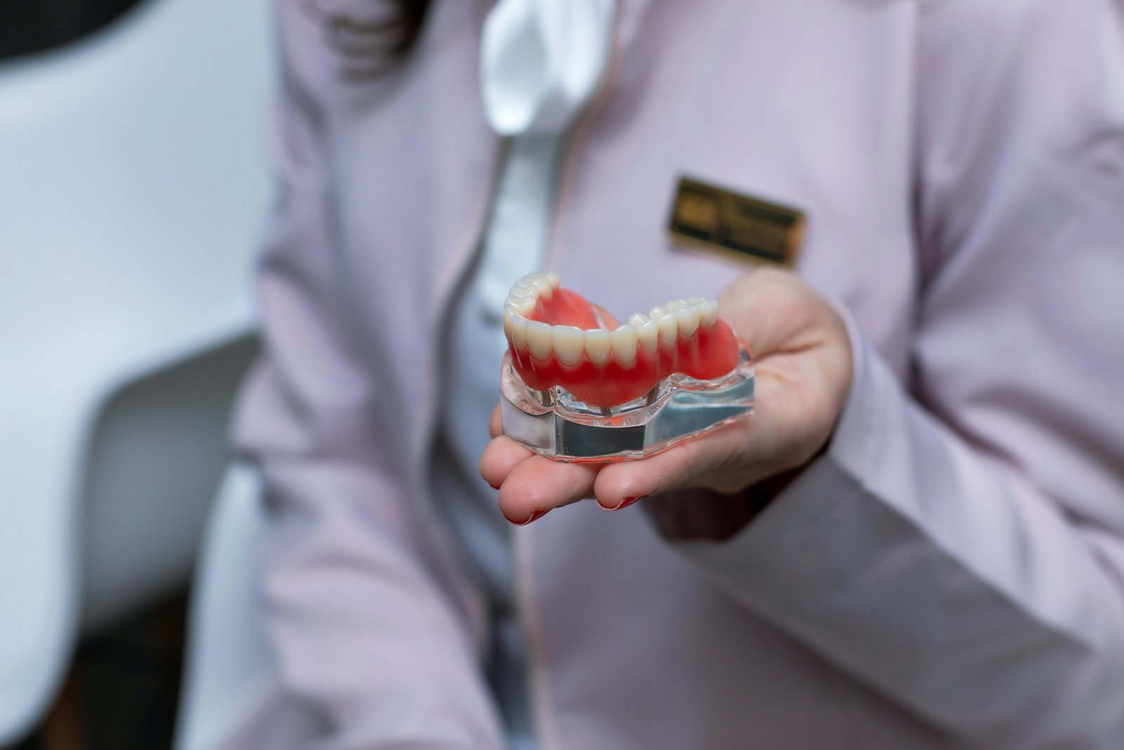 Implant-supported full-arch prosthesis